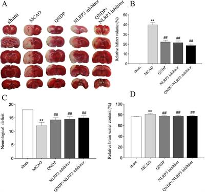 Neuroprotective Effects of Qingnao Dripping Pills Against Cerebral Ischemia via Inhibiting NLRP3 Inflammasome Signaling Pathway: In Vivo and In Vitro